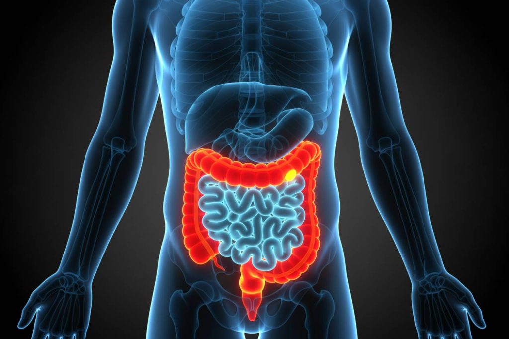 Allarme tumore al colon, crescita oltre l’80%: situazione gravissima | Gli esperti hanno capito la causa